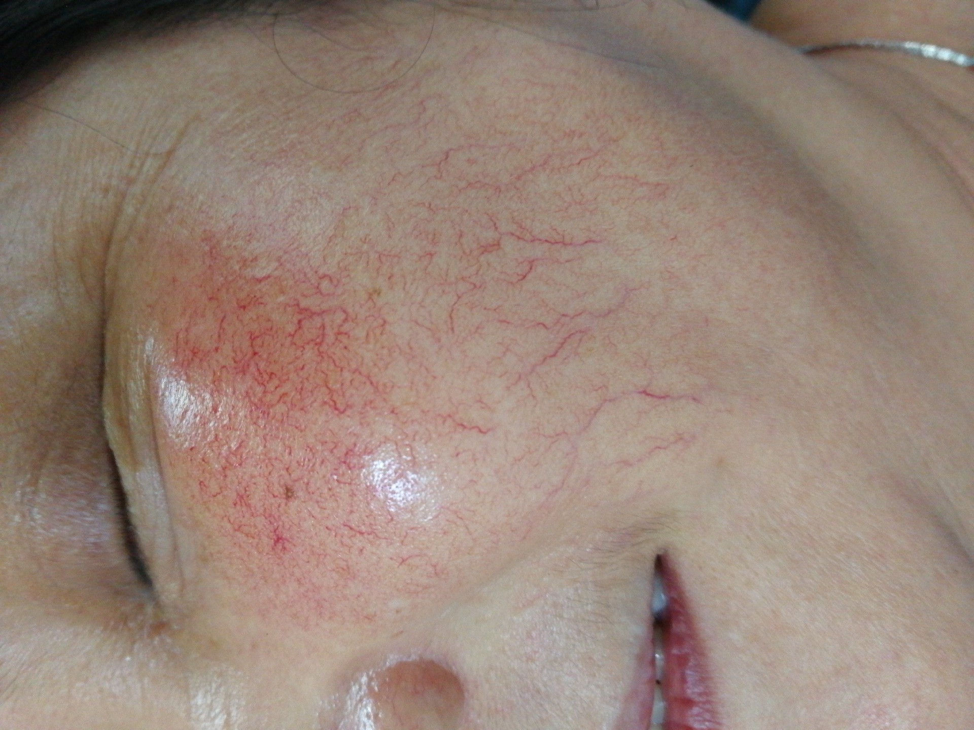 1740378380296396.jpg 1740378380296396.jpg