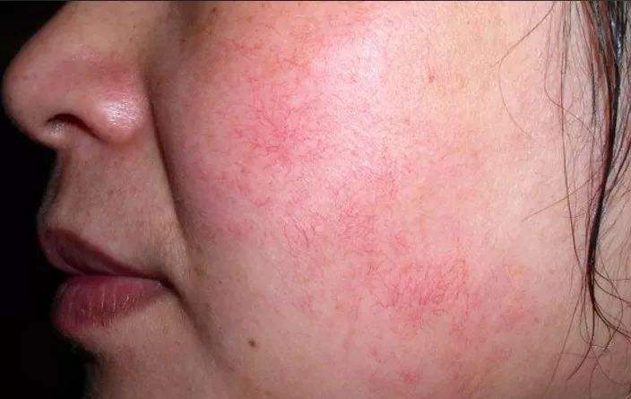 1742779338101745.jpeg 41b42c72746a0895a4d5a6ee509c18b7.jpeg